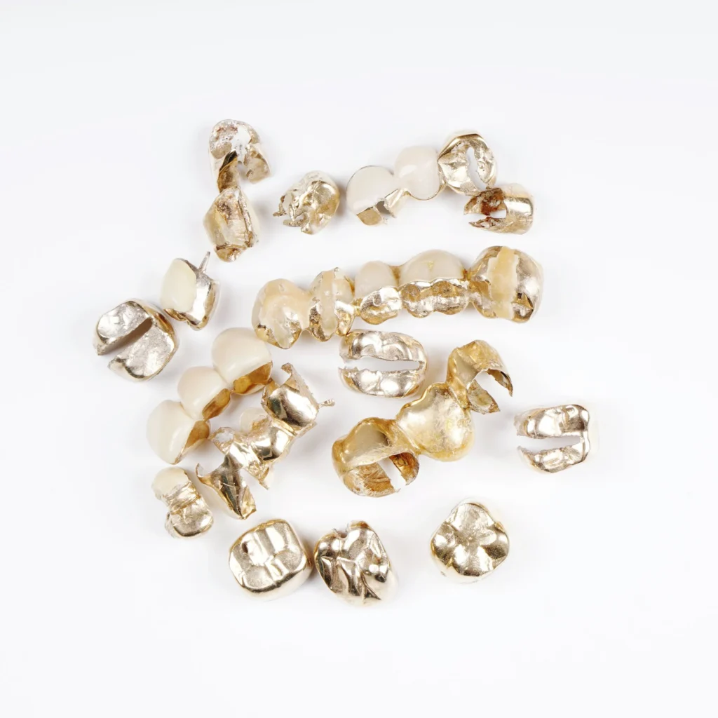 Types of Precious Metals We Accept